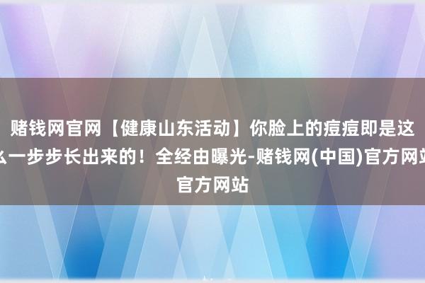 赌钱网官网【健康山东活动】你脸上的痘痘即是这么一步步长出来的！全经由曝光-赌钱网(中国)官方网站